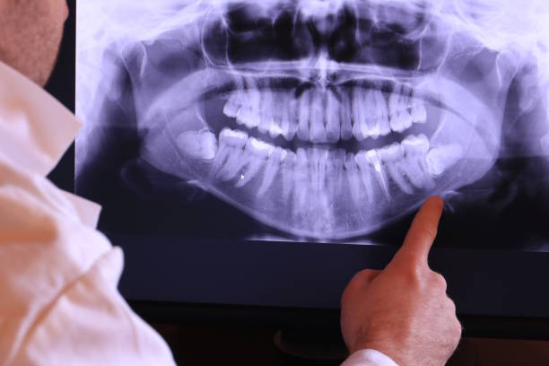Best Broken or Chipped Tooth Repair in Sherman, IL