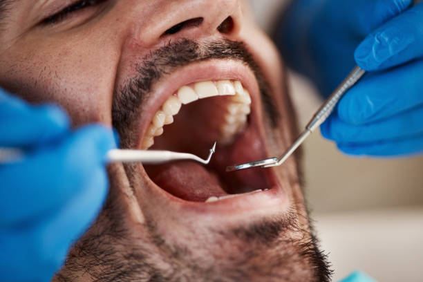 Best Emergency Dental Care for Sports Injuries in Sherman, IL